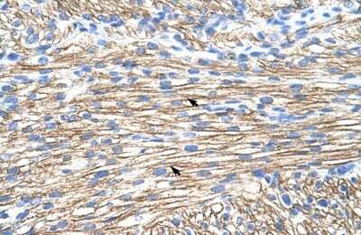 Immunohistochemistry-Paraffin: Muscleblind-like 1 Antibody [NBP1-80488]