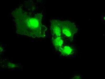 Immunocytochemistry/ Immunofluorescence: MxA/Mx1 Antibody (OTI2G12) [NBP1-47859]