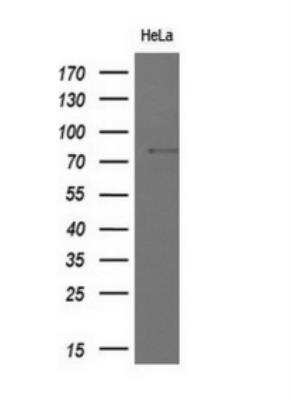 Western Blot: MxA/Mx1 Antibody (OTI2G12) [NBP1-47859]