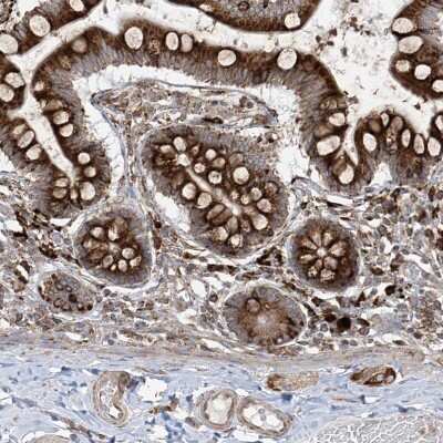 Immunohistochemistry-Paraffin: MxA/Mx1 Antibody [NBP1-83120]