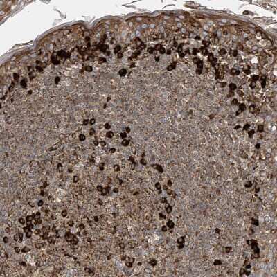 Immunohistochemistry-Paraffin: MxA/Mx1 Antibody [NBP1-83120]