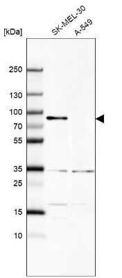 Western Blot: MxA/Mx1 Antibody [NBP1-83120]