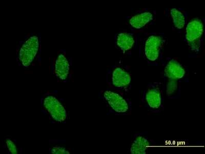Immunocytochemistry/ Immunofluorescence: Mxi1 Antibody (1B10) [H00004601-M11]