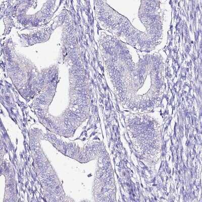 Immunohistochemistry-Paraffin: MyBPC3 Antibody [NBP2-13632]