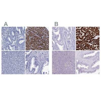 Immunohistochemistry-Paraffin: MyBPC3 Antibody [NBP2-13631]