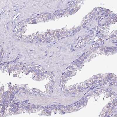 Immunohistochemistry-Paraffin: MyBPC3 Antibody [NBP2-13632]