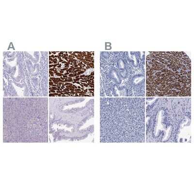 Immunohistochemistry-Paraffin: MyBPC3 Antibody [NBP2-13632]