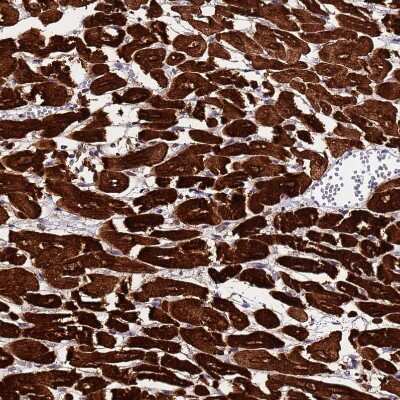 Immunohistochemistry-Paraffin: MyBPC3 Antibody [NBP2-13632]