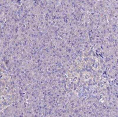 Immunohistochemistry-Paraffin: MyBPC3 Antibody [NBP2-13632]