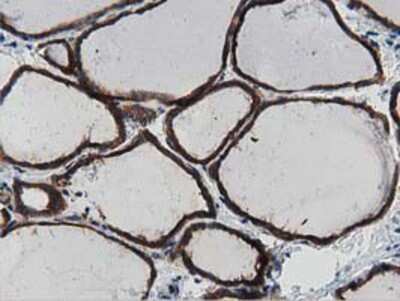 Immunohistochemistry-Paraffin: MyD88 Antibody (OTI2B2) [NBP2-03369]