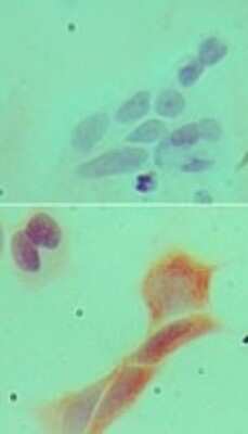 Immunocytochemistry/ Immunofluorescence: MyD88 Antibody (4D6) - BSA Free [NBP2-27369]