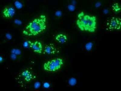 Immunocytochemistry/ Immunofluorescence: MyD88 Antibody (OTI2B2) - Azide and BSA Free [NBP2-72842]