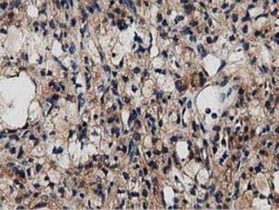 Immunohistochemistry: MyD88 Antibody (OTI2B2) - Azide and BSA Free [NBP2-72842]
