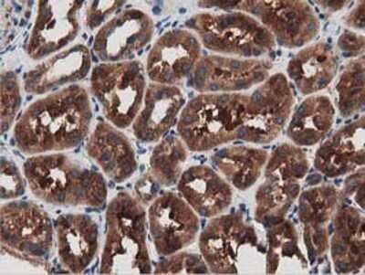 Immunohistochemistry: MyD88 Antibody (OTI2B2) - Azide and BSA Free [NBP2-72842]