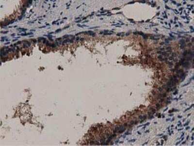 Immunohistochemistry: MyD88 Antibody (OTI2B2) - Azide and BSA Free [NBP2-72842]