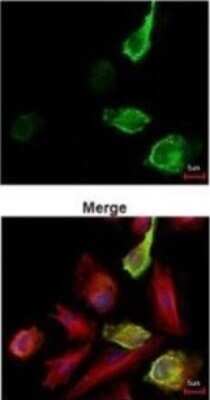 Immunocytochemistry/ Immunofluorescence: Myc Epitope Tag Antibody [NBP2-43691]
