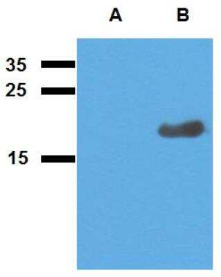 Western Blot: Mycobacterium tuberculosis antigen Acr2 Antibody [NBP2-62182]