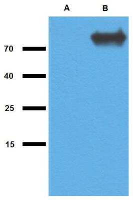 Western Blot: Mycobacterium tuberculosis antigen GlcB Antibody [NBP2-62184]