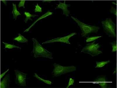 Immunocytochemistry/ Immunofluorescence: Myelin PLP Antibody (2D7) [H00005354-M03]