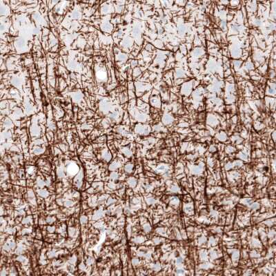 Immunohistochemistry-Paraffin: Myelin PLP Antibody (CL10622) [NBP3-07989]
