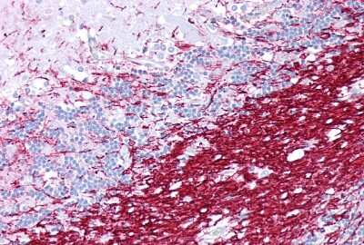 Immunohistochemistry-Paraffin: Myelin PLP Antibody [NBP1-60071]