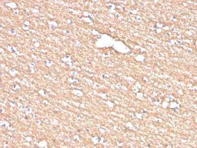 Immunohistochemistry-Paraffin: Myelin PLP Antibody (PLP1/4259) [NBP3-07603]