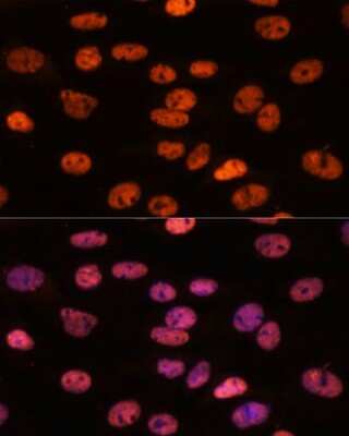 Immunocytochemistry/ Immunofluorescence: Myelin expression factor 2 Antibody - Azide and BSA Free [NBP2-93986]