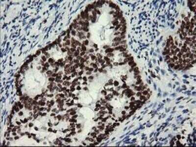 Immunohistochemistry: Myeloid leukemia factor 1 Antibody (OTI3A3) - Azide and BSA Free [NBP2-72846]