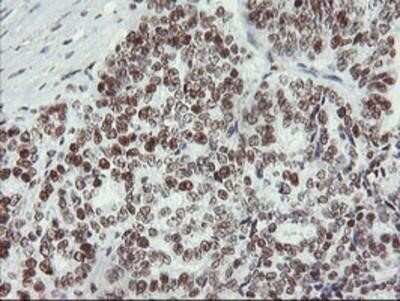 Immunohistochemistry-Paraffin: Myeloid leukemia factor 1 Antibody (OTI3A3) [NBP2-02052]