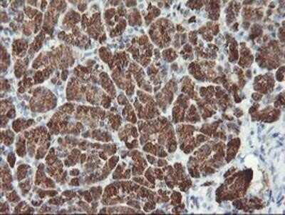 Immunohistochemistry-Paraffin: Myeloid leukemia factor 1 Antibody (OTI3A3) [NBP2-02052]