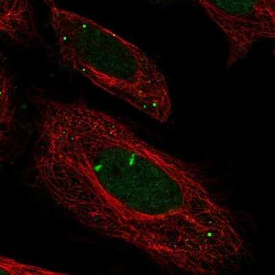 Immunocytochemistry/ Immunofluorescence: Myeloperoxidase/MPO Antibody [NBP2-38922]