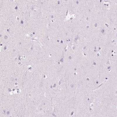 Immunohistochemistry-Paraffin: Myeloperoxidase/MPO Antibody [NBP1-87556]