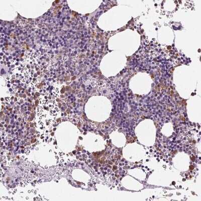 Immunohistochemistry-Paraffin: Myeloperoxidase/MPO Antibody [NBP1-87556]