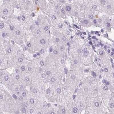Immunohistochemistry-Paraffin: Myeloperoxidase/MPO Antibody [NBP1-87556]
