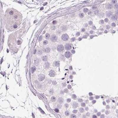 Immunohistochemistry-Paraffin: Myeloperoxidase/MPO Antibody [NBP1-87556]
