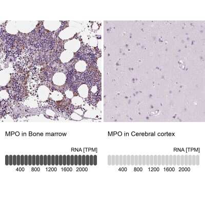 Immunohistochemistry-Paraffin: Myeloperoxidase/MPO Antibody [NBP1-87556]
