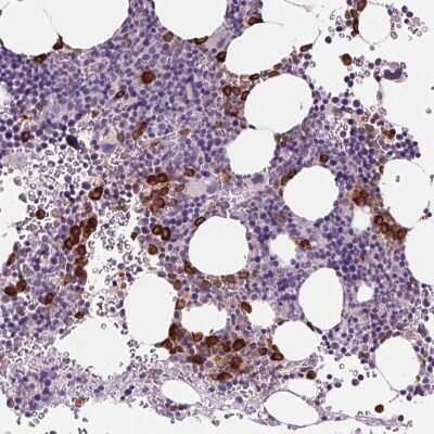 Immunohistochemistry-Paraffin: Myeloperoxidase/MPO Antibody [NBP2-38922]