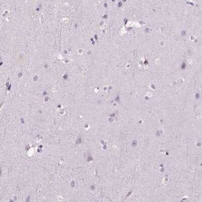 Immunohistochemistry-Paraffin: Myeloperoxidase/MPO Antibody [NBP2-38922]