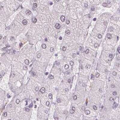 Immunohistochemistry-Paraffin: Myeloperoxidase/MPO Antibody [NBP2-38922]