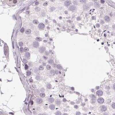 Immunohistochemistry-Paraffin: Myeloperoxidase/MPO Antibody [NBP2-38922]
