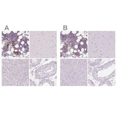 Immunohistochemistry-Paraffin: Myeloperoxidase/MPO Antibody [NBP2-38922]