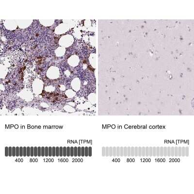 Immunohistochemistry-Paraffin: Myeloperoxidase/MPO Antibody [NBP2-38922]