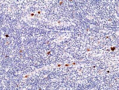 Immunohistochemistry-Paraffin: Myeloperoxidase/MPO Antibody (RM407) [NBP2-89098]
