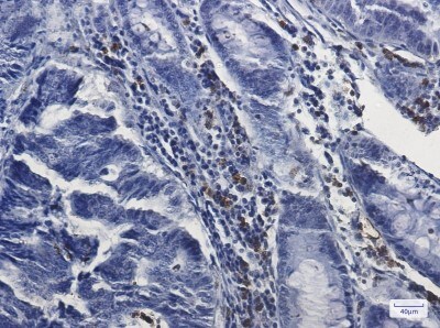 Immunohistochemistry-Paraffin: Myeloperoxidase/MPO Antibody (S07-2C7) [NBP3-19707]
