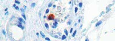 Immunohistochemistry-Paraffin: MyoD Antibody (5.2F) [NB120-788]