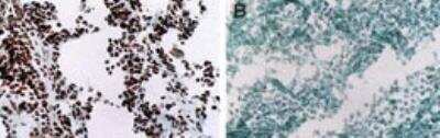 Immunohistochemistry-Frozen: MyoD Antibody (5.8A) - BSA Free [NB100-56511]