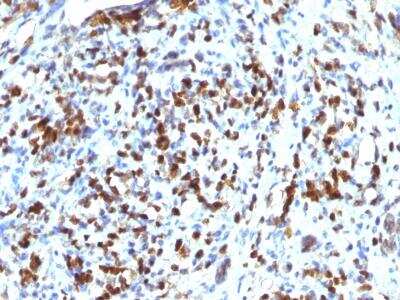 Immunohistochemistry-Paraffin: MyoD Antibody (MYOD1/2075R) [NBP2-75769]
