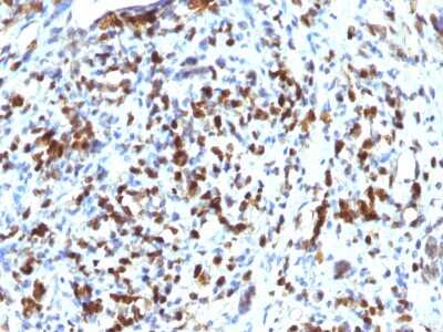 Immunohistochemistry-Paraffin: MyoD Antibody (MYOD1/2075R) [NBP2-75769]