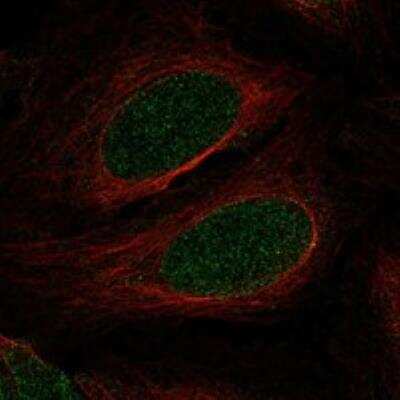 Immunocytochemistry/ Immunofluorescence: Myocardin Antibody [NBP3-17398]