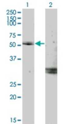 Western Blot: Myocilin Antibody (2B4) [H00004653-M02]